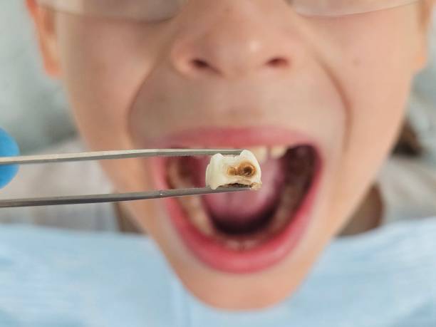 Best Weekend Emergency Dentist in Lake Kerr, FL