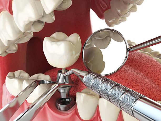 Best Same-Day Emergency Dentist in Lake Kerr, FL